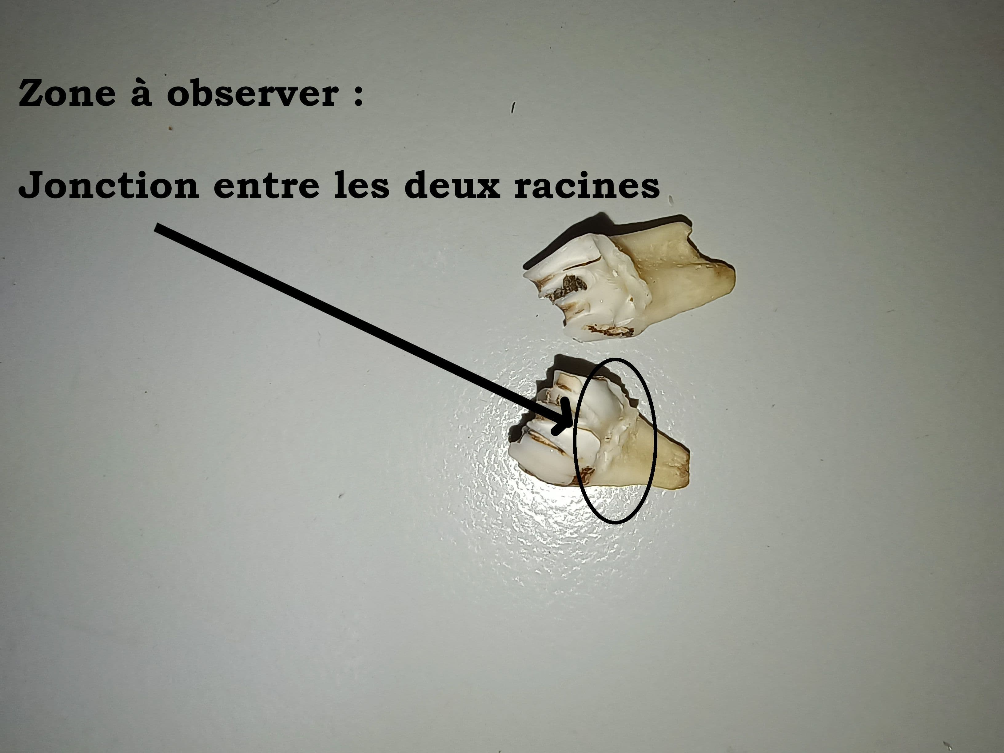 Découpe de la dent